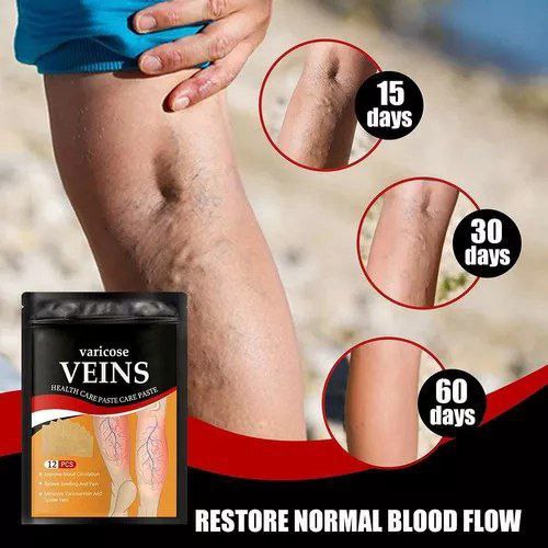 Super Oferta VaricEase Pro Reduce la Hinchazón y el Dolor