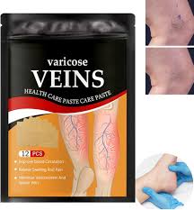 Super Oferta VaricEase Pro Reduce la Hinchazón y el Dolor